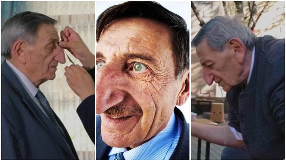 A murit Mehmet Özyürek, bărbatul cu cel mai mare nas din lume