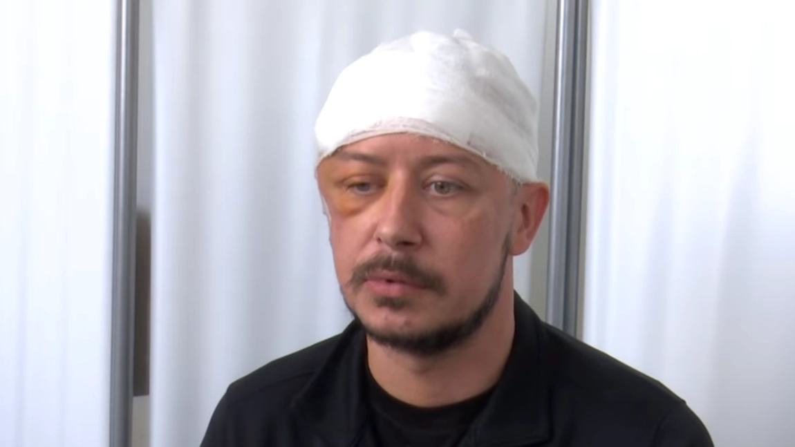 IT-istul de 37 de ani care învinge o tumoare cerebrală printr-o intervenție chirurgicală de excepție, cu ajutorul medicilor de la Spitalul „Prof. Dr. Nicolae Oblu” din Iași - VIDEO