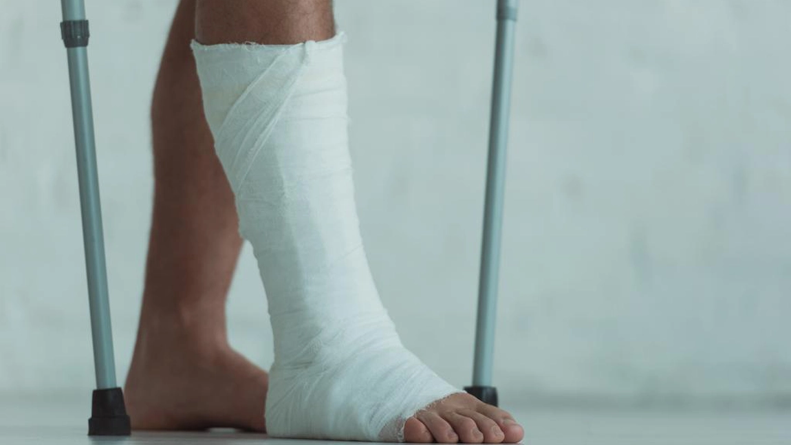 Ce reguli să respecți când ai piciorul în ghips. Cum să grăbești recuperarea?