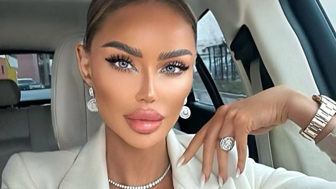 Bianca Drăgușanu suferă de diabet. Ce nu are voie să mănânce