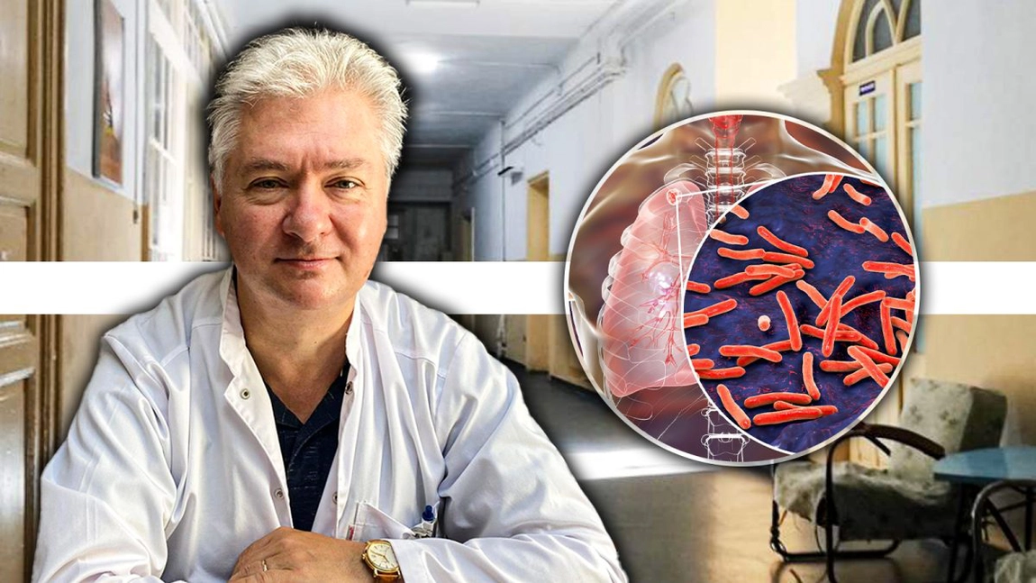 Cazurile grave de tuberculoză sunt în creștere. Medicii trag un semnal de alarmă: „Formele grave de TBC au crescut cu 30 la sută” - FOTO