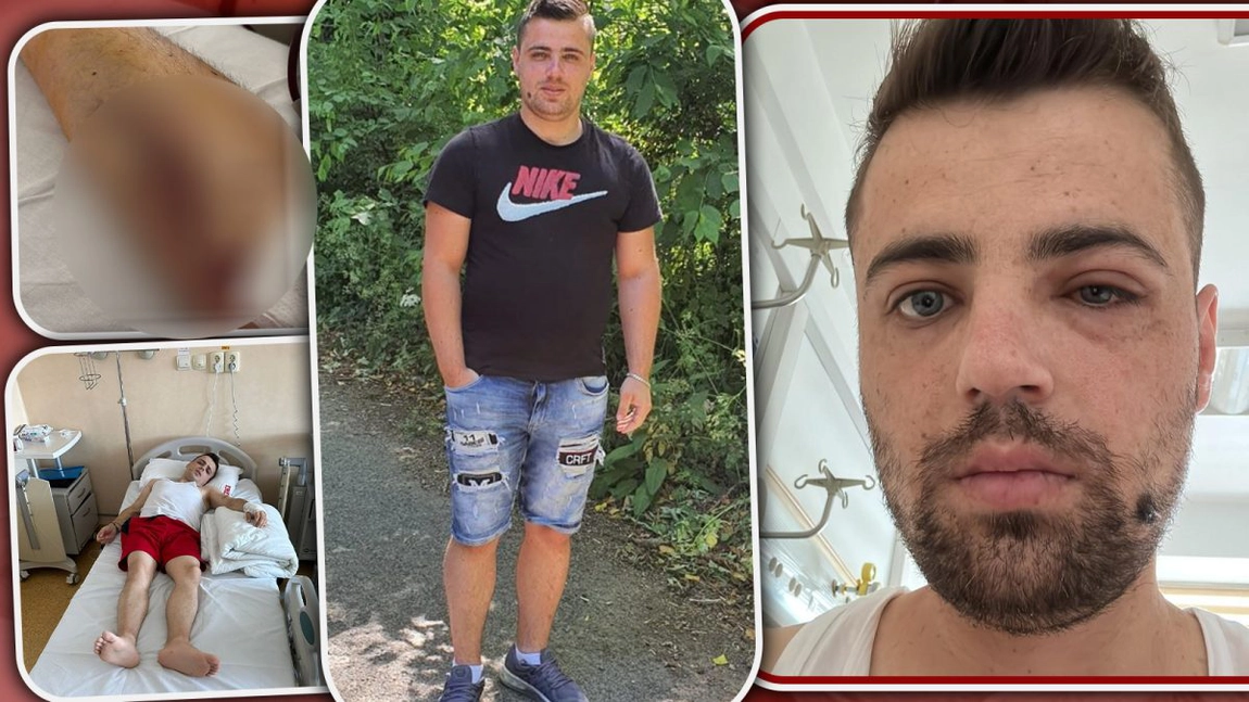 Imagini greu de privit! A fost cel mai bolnăvicios dintre frați, iar părinții l-au abandonat pentru totdeauna: este în ultima fază a bolii - FOTO