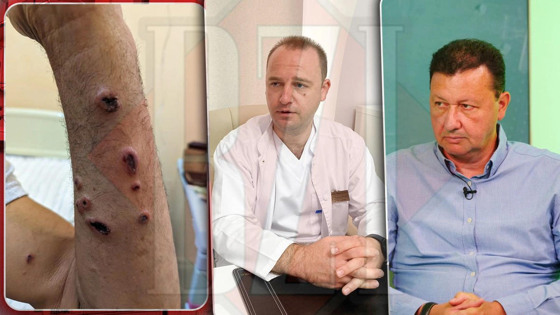 Alertă în Iași! DSV a declanșat o anchetă în cazul celor trei bărbați internați la Spitalul de Boli Infecțioase, diagnosticați cu antrax - FOTO