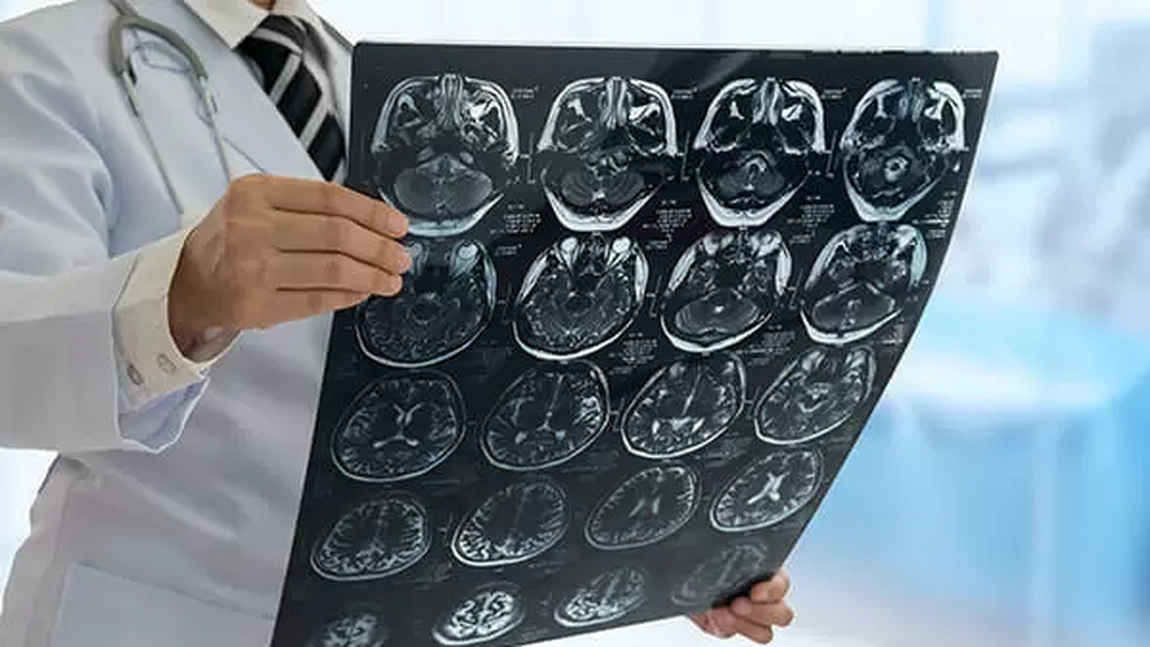 Cât trăieşte un bolnav de Alzheimer? Care sunt primele simptome ale acestei afecțiuni