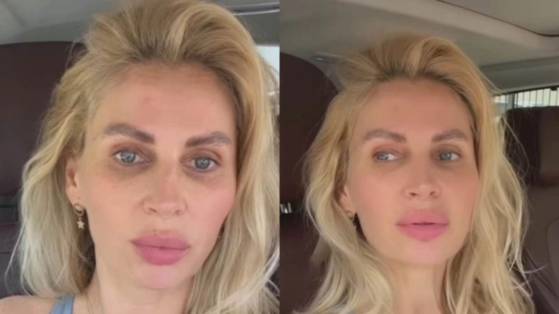 Andreea Bănică s-a afișat nemachiată, plină de pistrui și pete. Cum arată de fapt artista