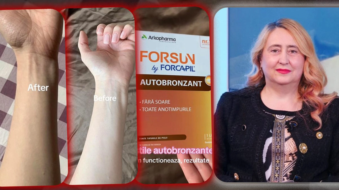 Și-au dorit un bronz perfect, dar s-au trezit cu pielea portocalie după ce au folosit pastile autobronzante. Adolescentele nu țin cont de riscurile enorme la care se supun: „Nu sunt sigure, nu există niciun studiu în acest sens” - FOTO