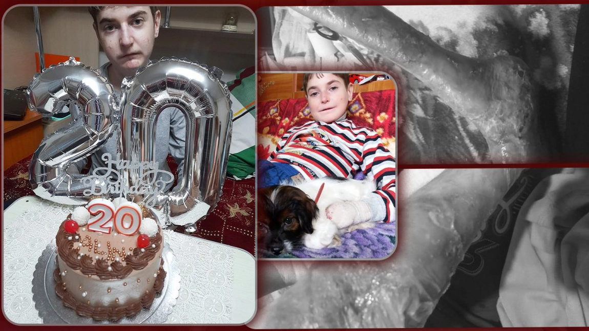 Când s-a împărțit durerea, un tânăr a primit mai mult decât putea duce. Alin se luptă, de 20 de ani, cu o boală care-i mănâncă trupul - FOTO