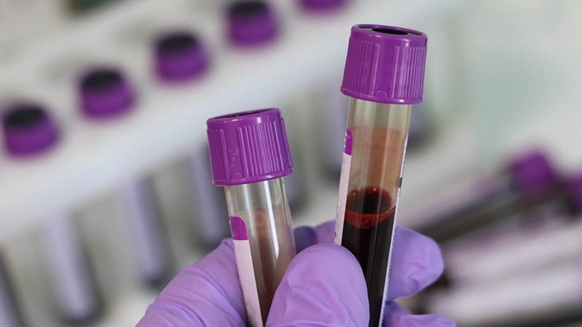 Ce înseamnă hemoglobină eritrocitară medie scăzută? Ce afecțiune ascunde această valoare