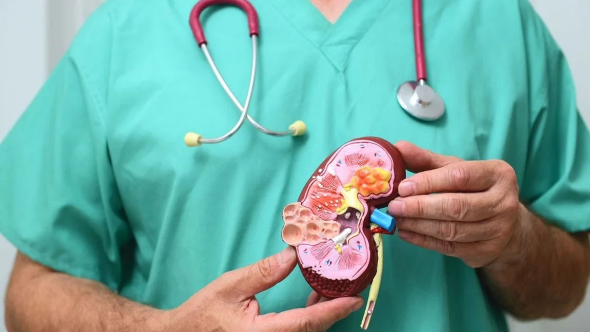 Calciu seric mărit. Hipercalcemia netratată îți poate pune în pericol viața