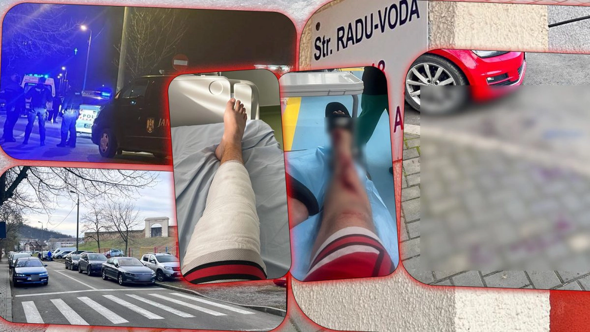 Atac sângeros în Frumoasa! Mai multe persoane s-au „măcelărit” în stradă, iar un minor a ajuns tăiat la spital. Totul s-a întâmplat fără motiv? - FOTO