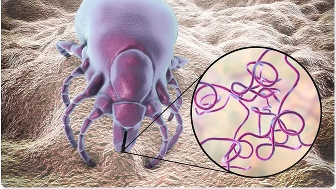Ce trebuie să știi despre Borrelia burgdorferi. Bacteria responsabilă de boala Lyme