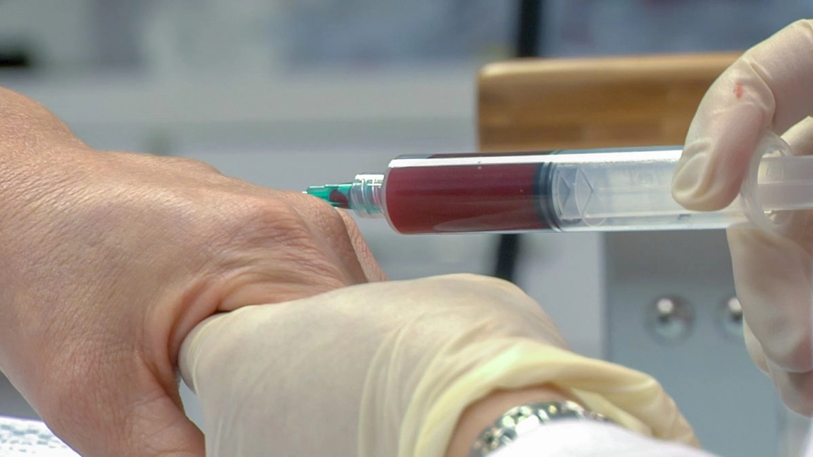 Tratament cu plasmă PRP și ozonoterapia. Două proceduri medicale miraculoase pentru regenerarea țesuturilor