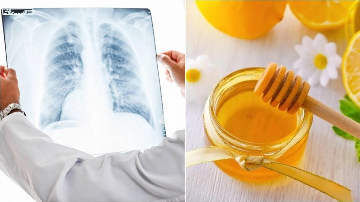 Cele mai bune ceaiuri pentru plămâni. Leacuri naturiste pentru afecțiunile pulmonare