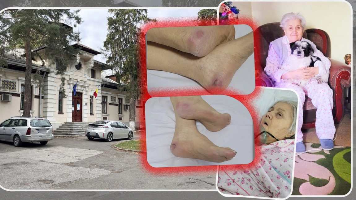 Discuții șocante la Institutul de Psihiatrie „Socola” din Iași! În două săptămâni, o bătrână a ajuns să fie plină de răni! Un infirmier către paciente: „Haideți, bunicuțelor, să vă văd la fofoloancă” – FOTO