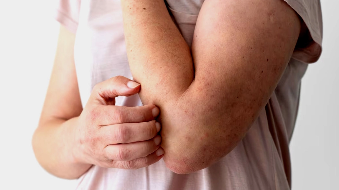 Ce întreține inflamația în organism. Analizele care indică prezența agenților patogeni