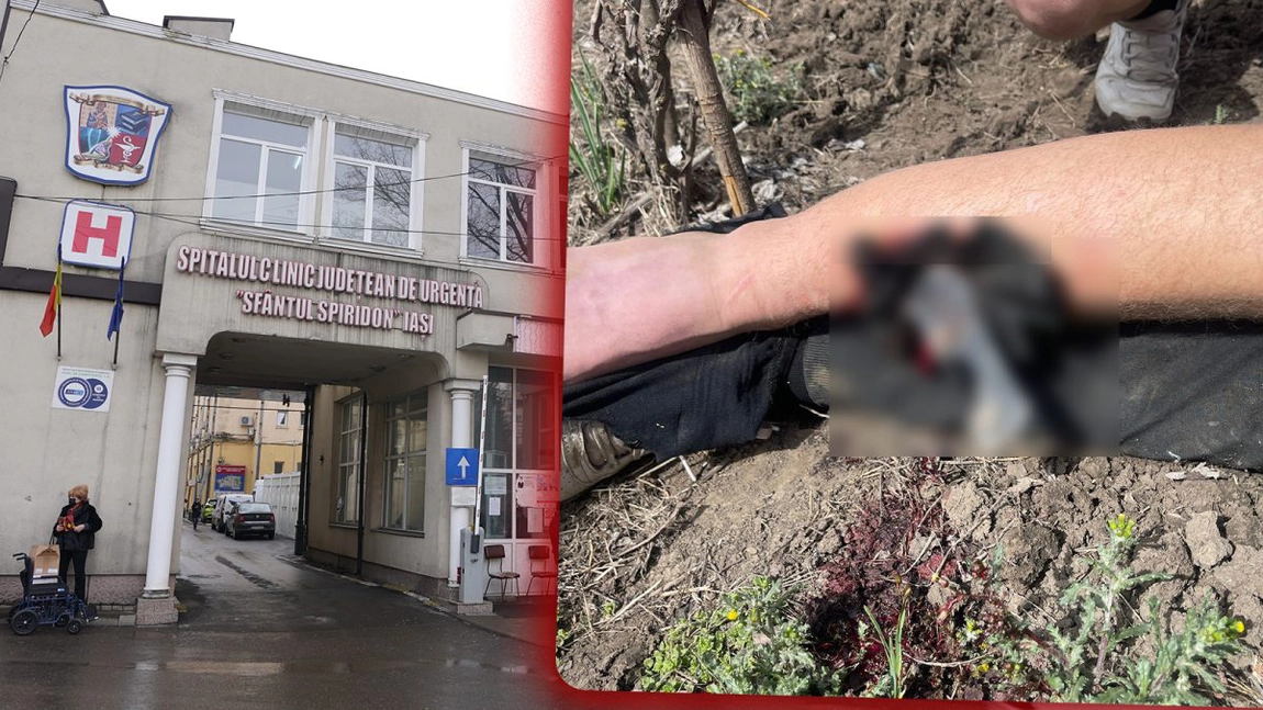 Care este starea celor trei bărbați care au ajuns la Spitalul „Sf. Spiridon” Iași după ce au fost răniți de utilaje: „Nu au suferit amputații”