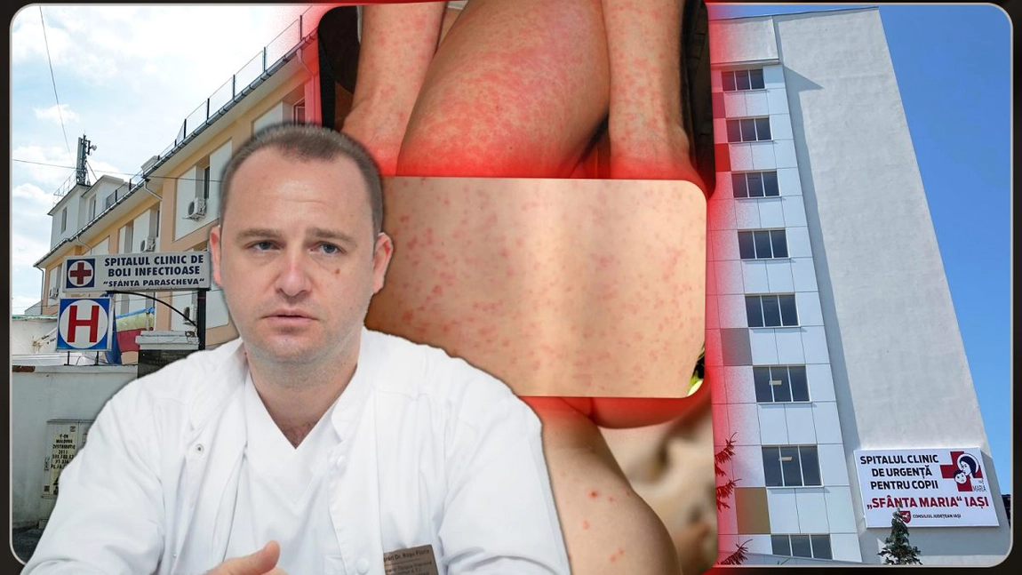 Medicii ieșeni îi liniștesc pe părinți! Nu ne confruntăm cu o epidemie de scarlatină: „Nu sunt mai multe cazuri decât de obicei” - FOTO