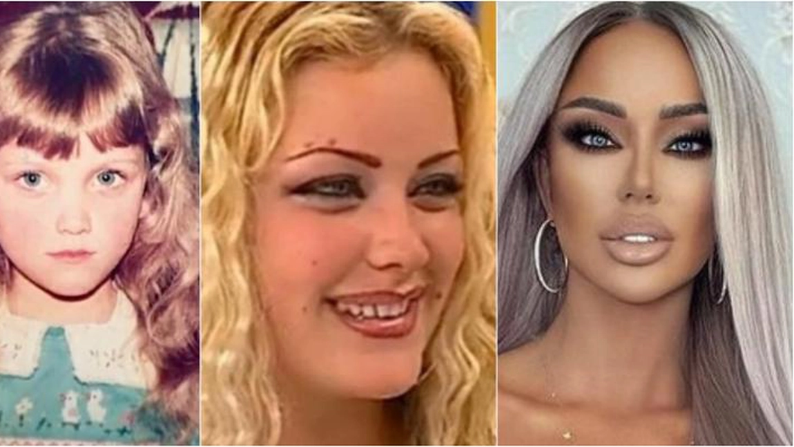 Cum arăta Bianca Drăgușanu tânără? Internauții spun că era mult mai frumoasă înainte de zecile de operații estetice