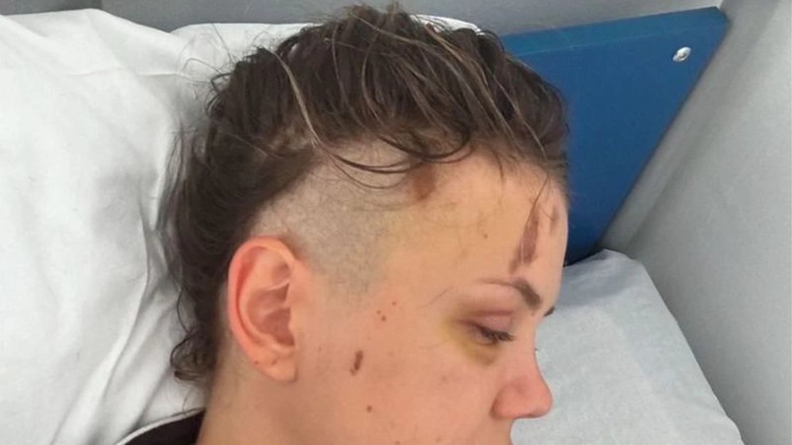 Emily Burghelea, rasă pe cap înainte de operație! „Moartea ne-a făcut cu mâna!“