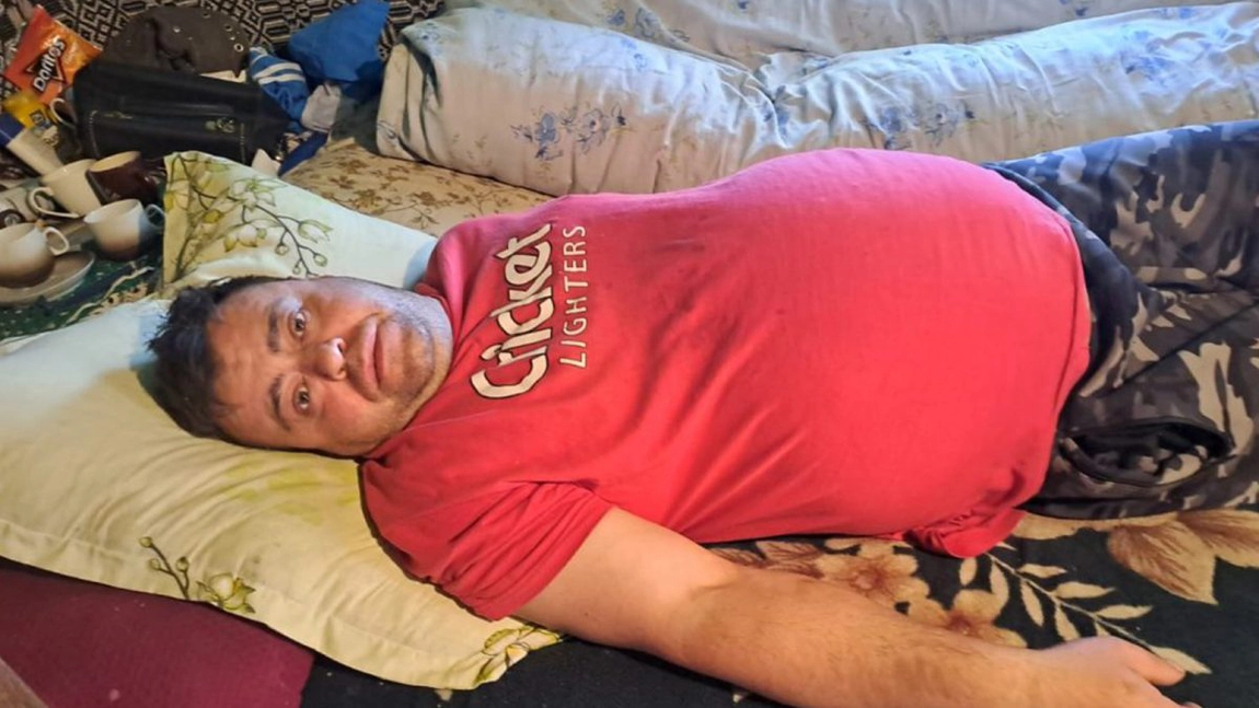 Acest bărbat trăiește, de 6 luni, un adevărat coșmar! Din cauză că burta îi crește de la o zi la alta, Mihai Burlacu nici nu se mai poate încălța singur