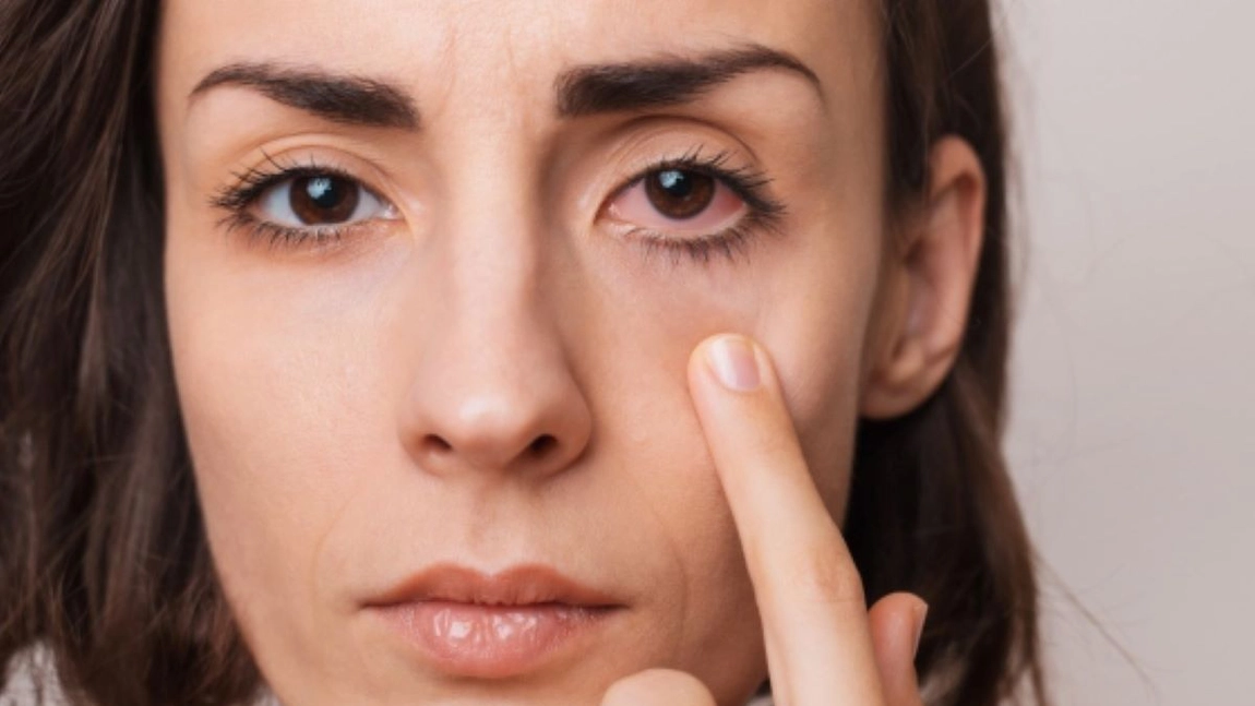 Cele mai întâlnite boli ale ochilor! Află cum să le depistezi la timp!