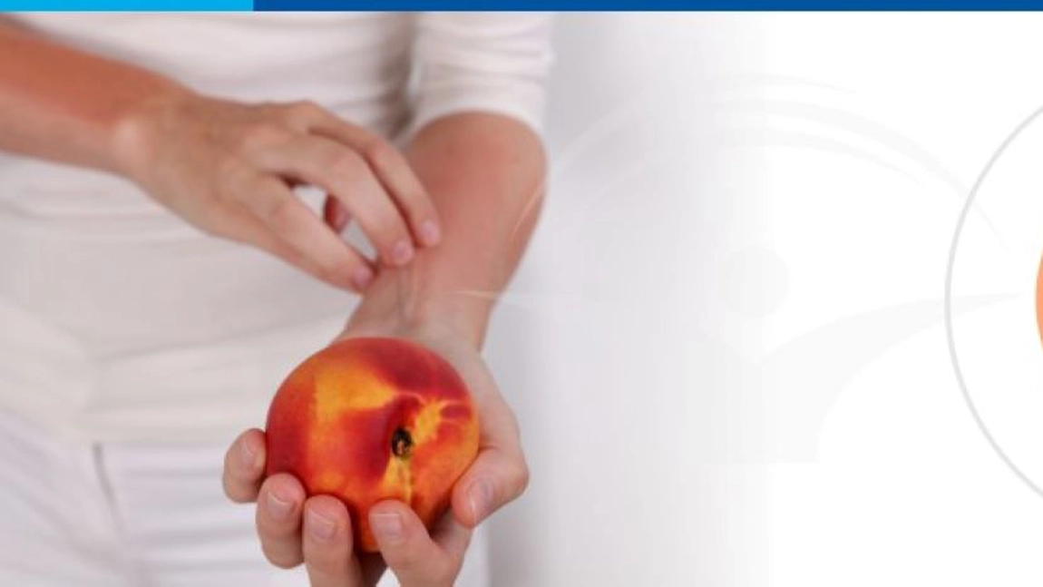Cum știi că suferi de o alergie alimentară. Primele simptome și la ce trebuie să fim atenți