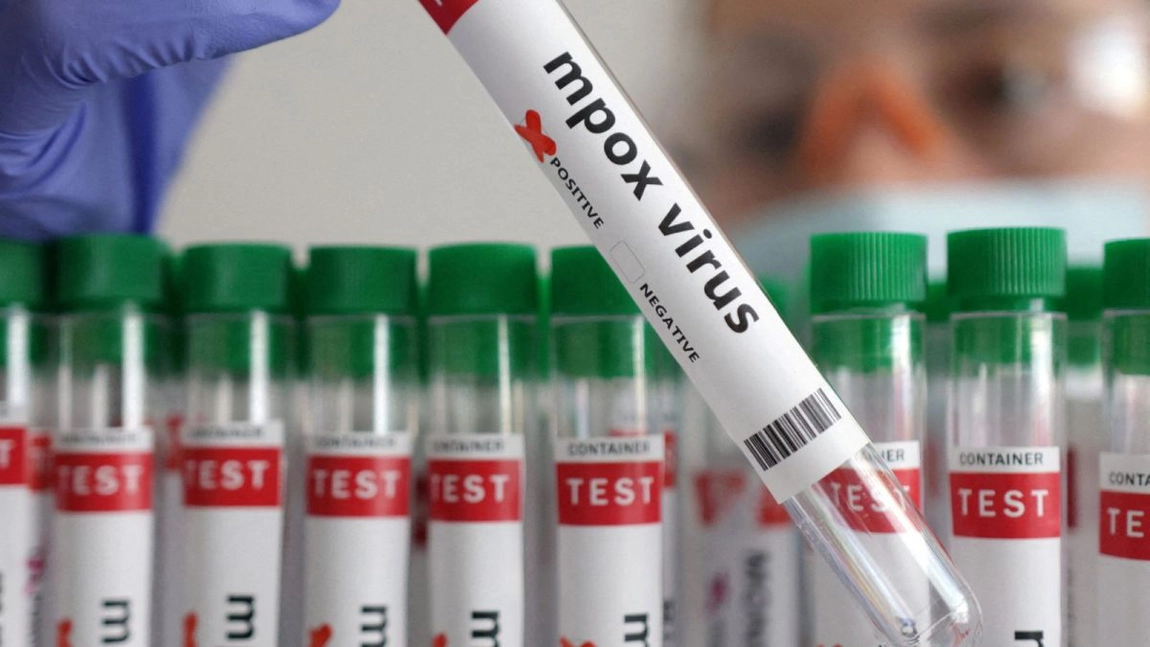 Un caz de infectare cu noua variantă a virusului mpox a fost confirmat pe teritoriul Europei, în Germania