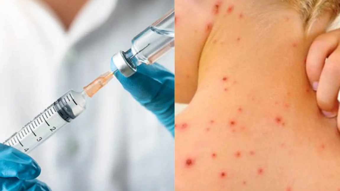 Tot mai mulți părinți refuză să-și vaccineze copilul împotriva rujeolei: „Nu vreau să bag toate prostiile în el!”