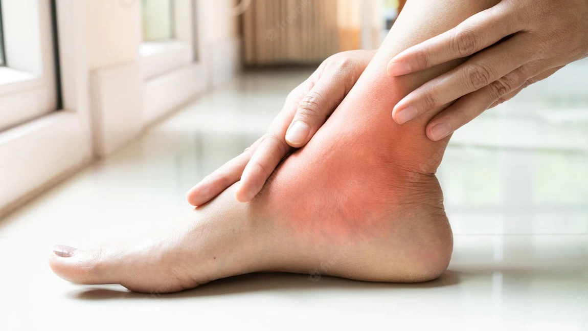 Picior umflat și ulcer varicos. Simptome, cauze și tratament