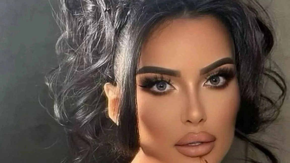 A cheltuit o avere ca să arate ca Kim Kardashian! Operațiile au dus-o la infertilitate!
