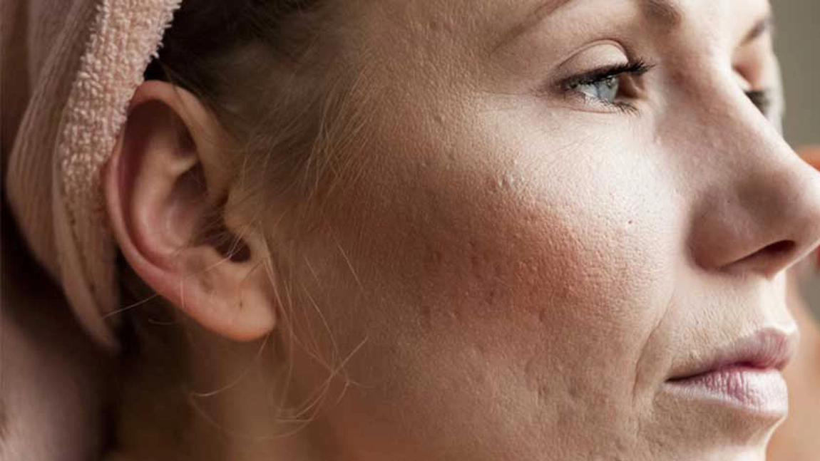 Dermatita la adulți, poze. Ce remedii naturiste poți folosi pentru tratarea pielii