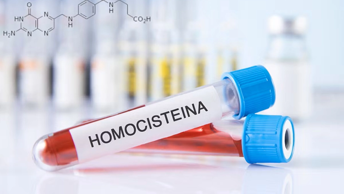 Ce e homocisteina? Iată de ce este importantă monitorizarea acesteia