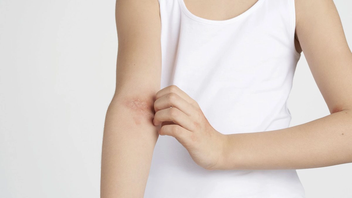 Pentru ce e bun fluocinolon? Iată cum scapi de inflamațiile pielii!
