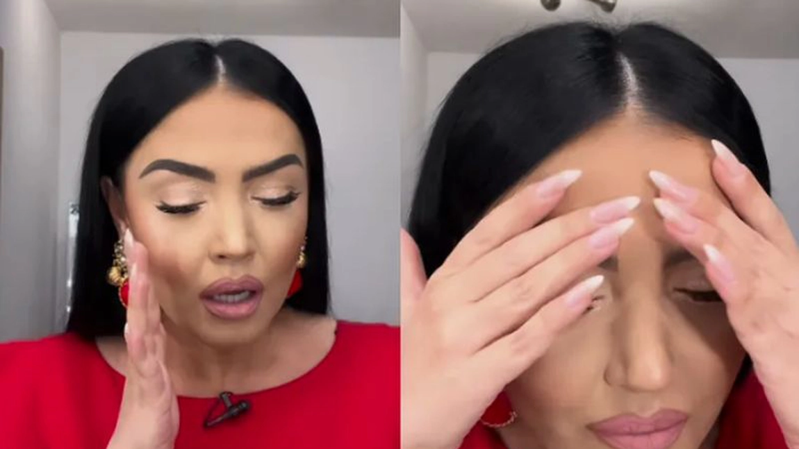 Andreea Mantea a spus de ce a apărut cu fața umflată: „Tremur de durere!”