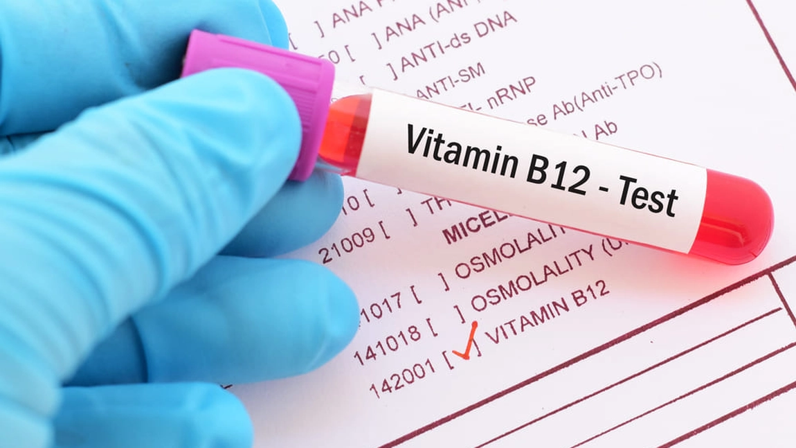 Ce boli ascunde o valoare crescută a vitaminei B12 și care sunt cauzele. Află dacă are un efect negativ asupra sănătății