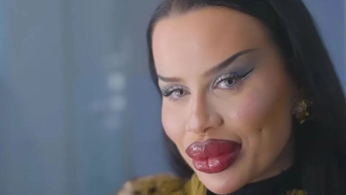 E dependentă de botox! „Prietenii spun că îmi voi distruge fața, dar eu ador aspectul fals!”