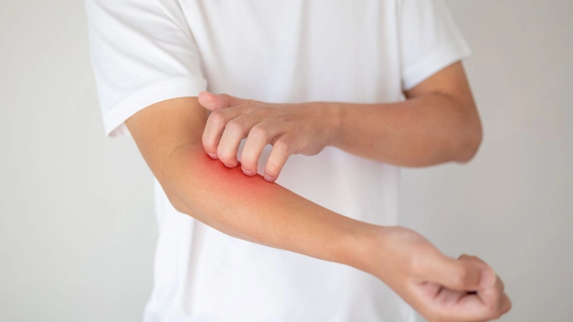 Cum să tratezi dermatita atopică la copii. Care sunt cauzele ce stau la baza erupției cutanate