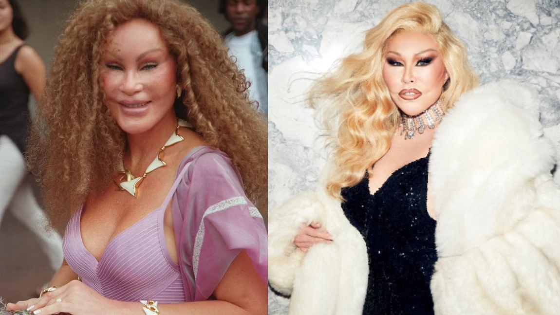 Jocelyn Wildenstein, supranumită „Catwoman”, s-a stins din viață la 84 de ani