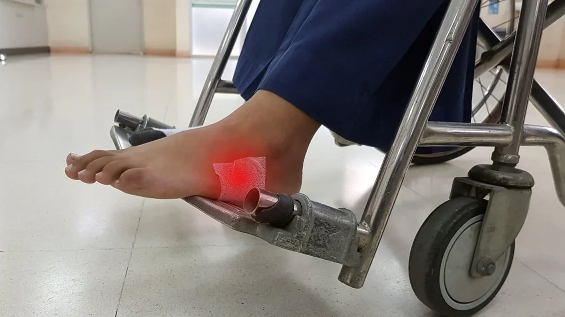 Necroza, cauze, simptome și părțile corpului pe care le poate afecta