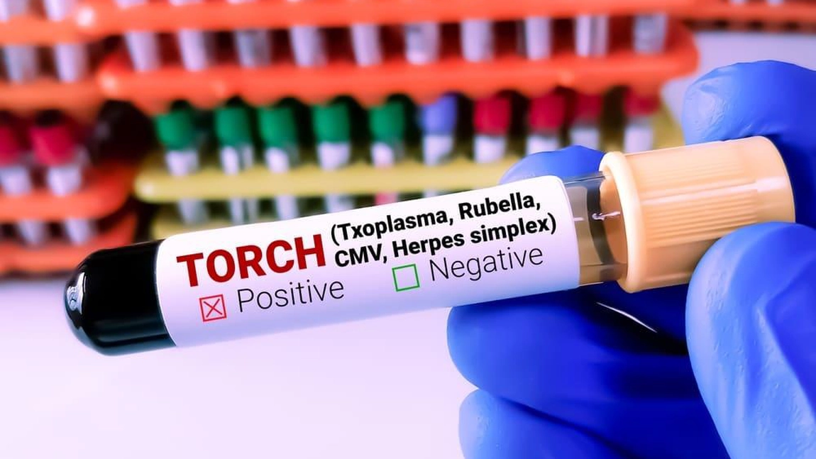 Cât costă să-ți faci un profil TORCH la Spitalul Arcadia, Clinica Sante, Synevo
