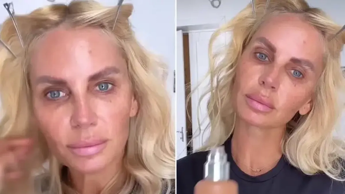 Andreea Bănică a suferit un accident. “De mult nu am mai avut o perioadă așa de grea”