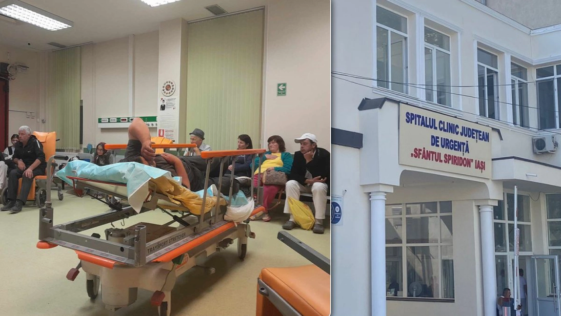 Doi frați din Târgu Frumos i-au uimit pe medicii de la Spitalul Clinic „Sf. Spiridon” Iași! Prof. dr. Diana Cimpoeșu: „Suntem în anul 2025 și încă mai avem pacienți cu așa ceva”