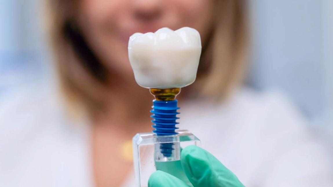 Care sunt simptomele respingerii unui implant dentar? Iată ce este de făcut