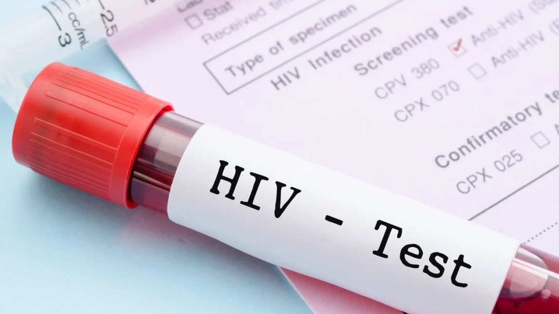 Numărul persoanelor infectate cu HIV ar putea să crească cu 2.000 de cazuri în fiecare zi, din cauza sistării sprijinului oferit de SUA