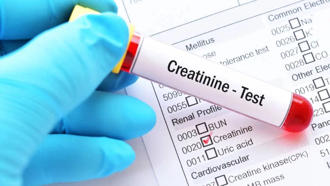 Tot ce trebuie să știi despre creatinină – Valori normale și efectele scăderii și creșterii acesteia