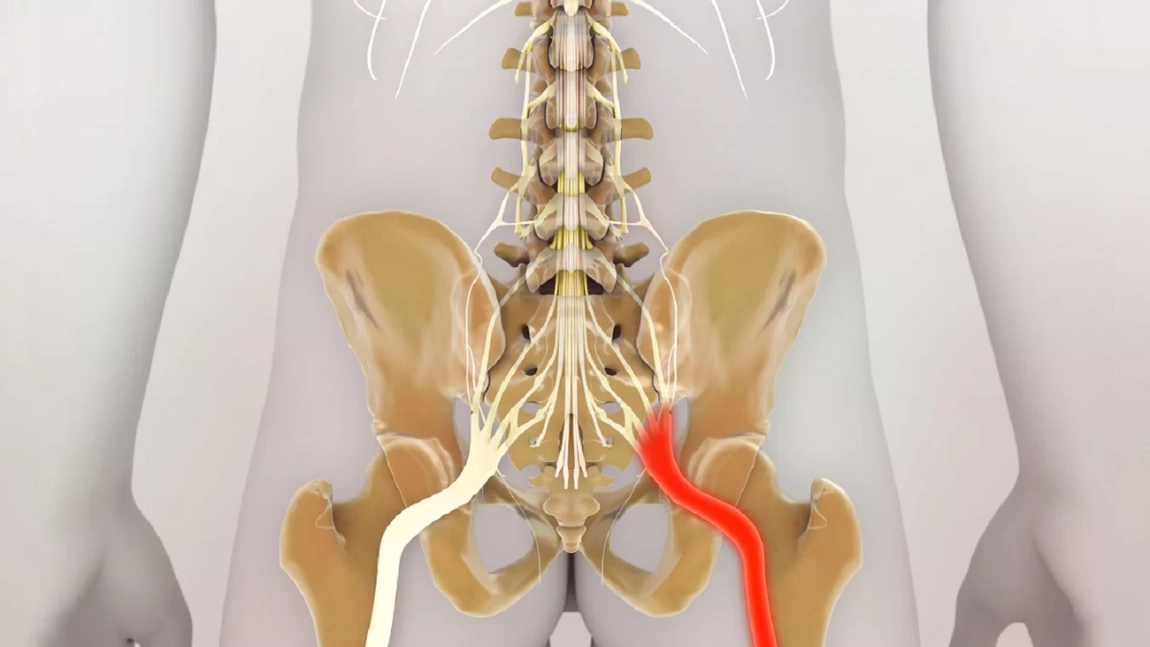 Unde se află nervul sciatic? Află tot ce trebuie să știi despre acesta