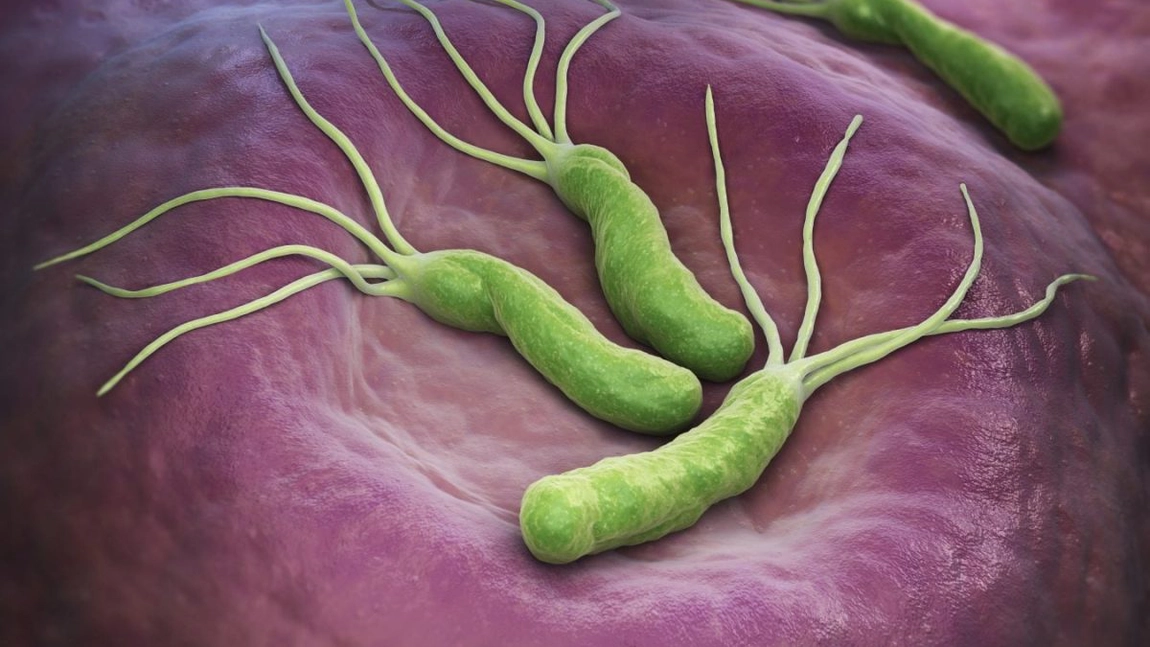Simptome helicobacter, cum le recunoști? Află care sunt semnele ale unei infecții periculoase!