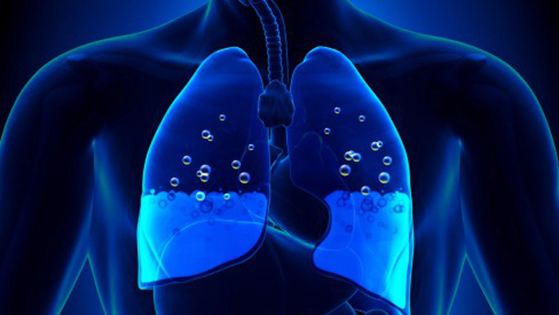 Edem pulmonar. Șanse de supraviețuire și cât de grave sunt simptomele