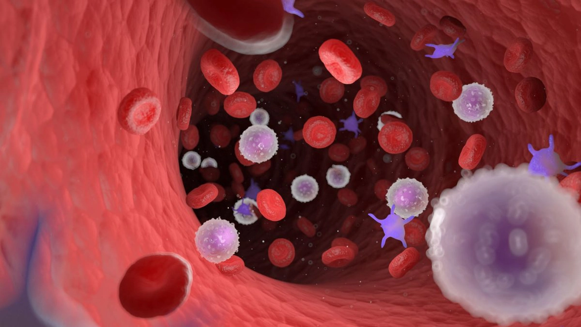 Leucemia acută este o formă gravă de cancer al sângelui, care necesită tratament imediat!