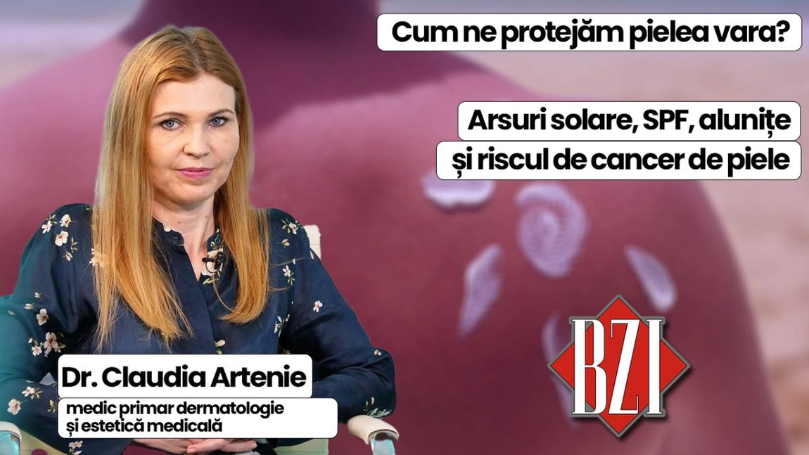 LIVE VIDEO - Sănătatea pielii vara, arsuri solare, alunițe periculoase și protecția corectă cu SPF, subiectul emisiunii de sănătate BZI LIVE, împreună cu invitata dr. Claudia Artenie, medic primar dermatologie și estetică medicală